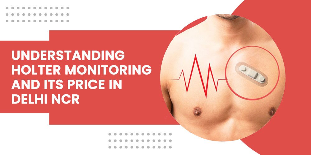 holter-monitoring-price-delhi-ncr
