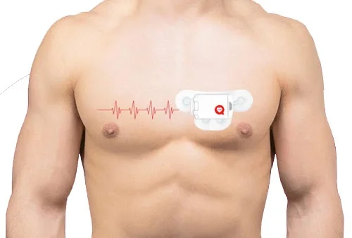 holter-monitor-wireless
