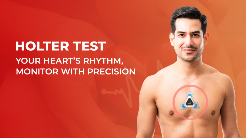 holter-test-delhi